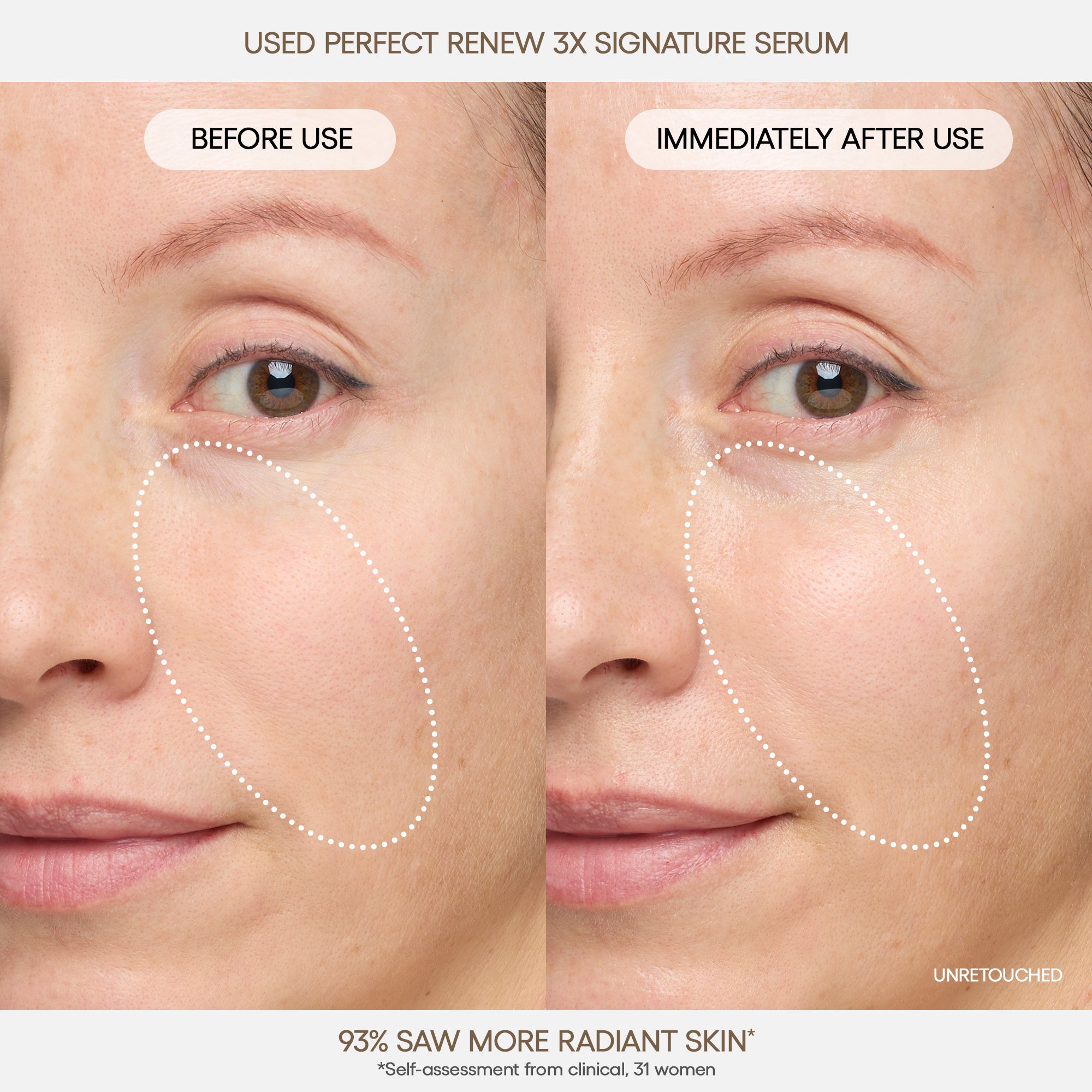 Perfect Renew 3X Signature Serum - Image 3